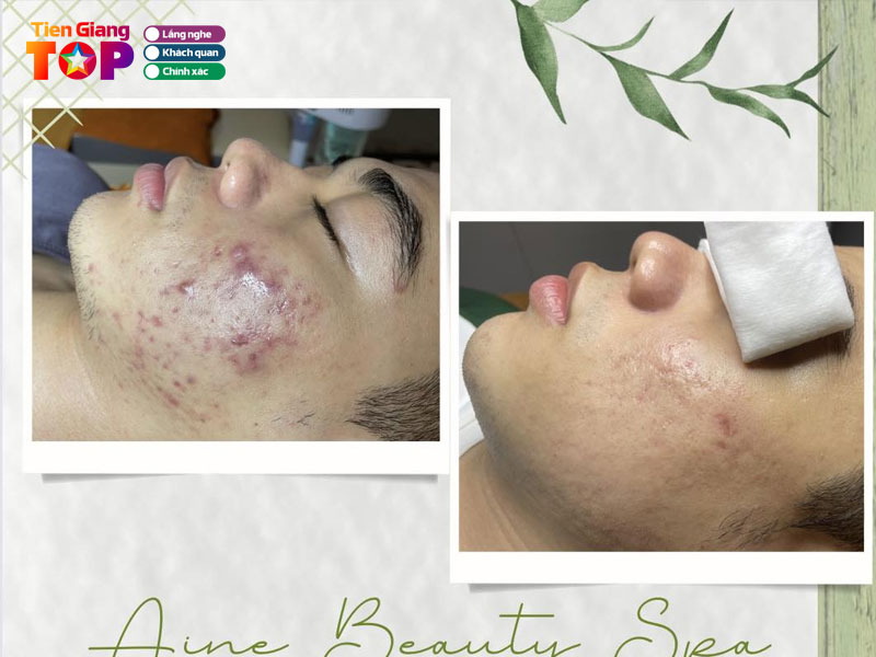 Aine-beauty-spa-tiengiangtoplist