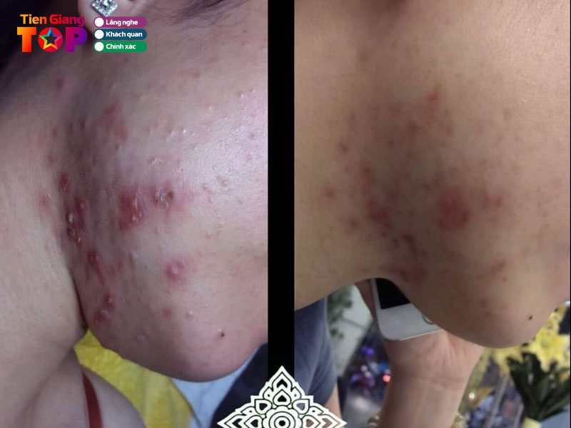 Beauty-de-siam-tiengiangtoplist