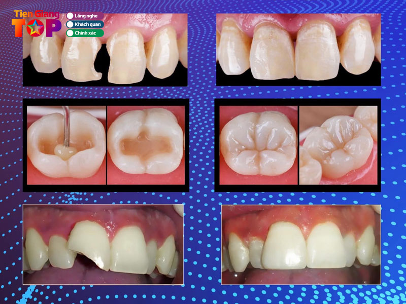 He-thong-nha-khoa-sai-gon-tiengiangtoplist