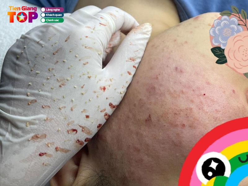 Huyen-tran-spa-tiengiangtoplist