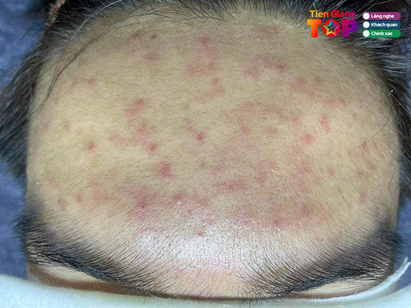 Moc-beauty-spa-tiengiangtoplist