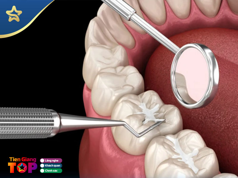 Nha-khoa-5s-tiengiangtoplist