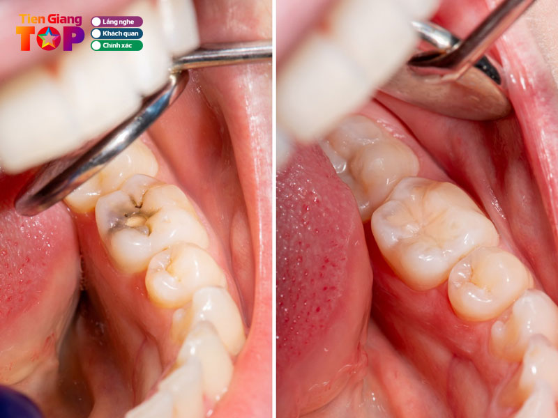 Nha-khoa-kim-tiengiangtoplist