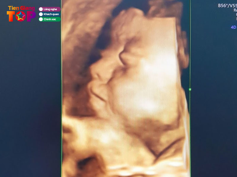 Phong-kham-san-phu-khoa-bs-bui-van-phuong-tiengiangtoplist