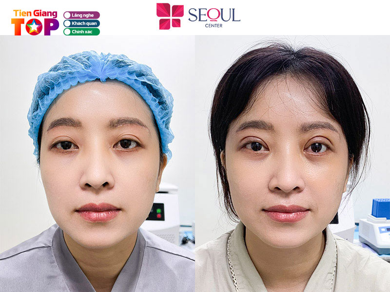 Seoul-center-tiengiangtoplist