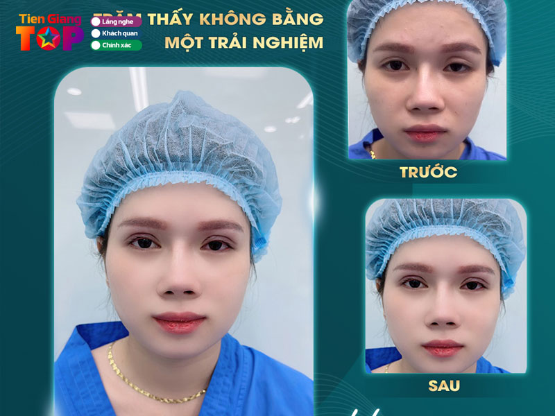 Tham-my-vien-america-tiengiangtoplist