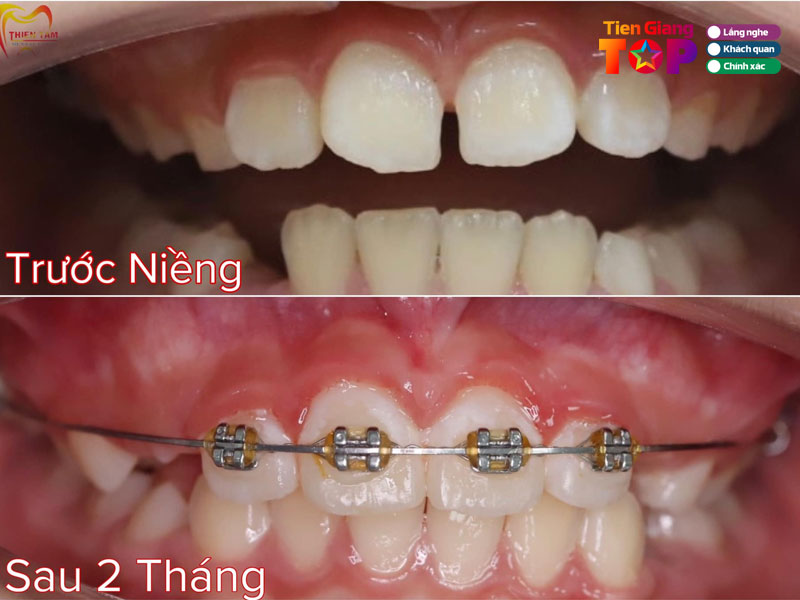 He-thong-nha-khoa-sai-gon-thien-tam-tiengiangtoplist