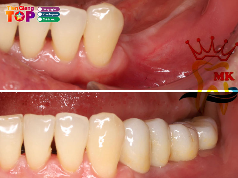 Nha-khoa-mekong-my-tho-tiengiangtoplist