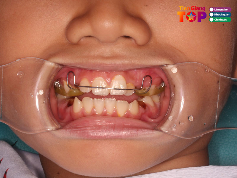 Nha-khoa-vui-tiengiangtoplist