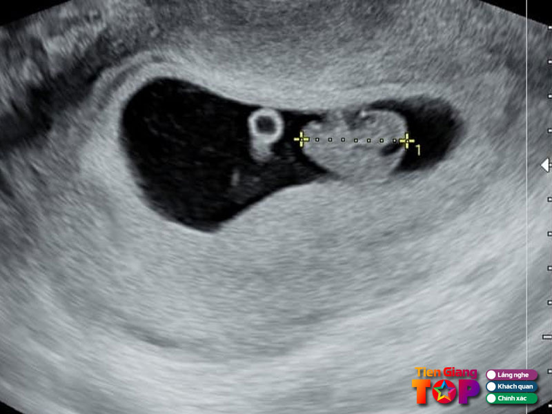 Phong-kham-phu-san-bs-nguyen-ngoc-thanh-tiengiangtoplist