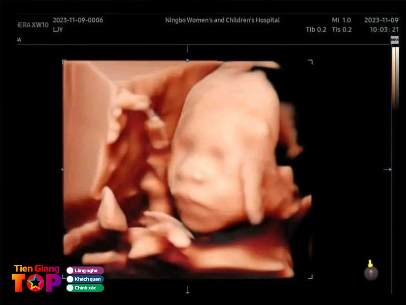 Phong-kham-san-phu-khoa-bs-tran-tuy-phuong-tiengiangtoplist