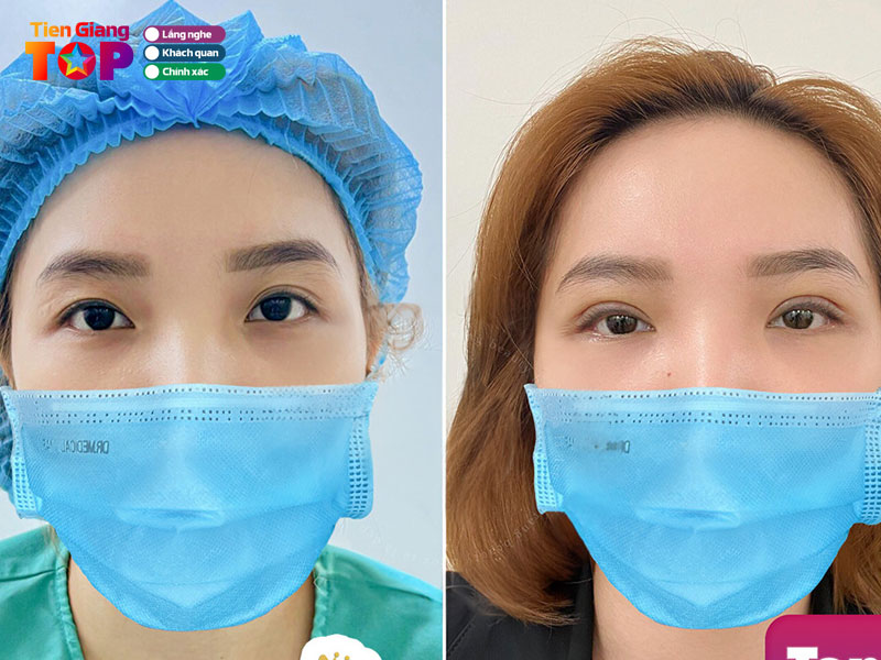 Tham-my-vien-america-my-tho-tiengiangtoplist