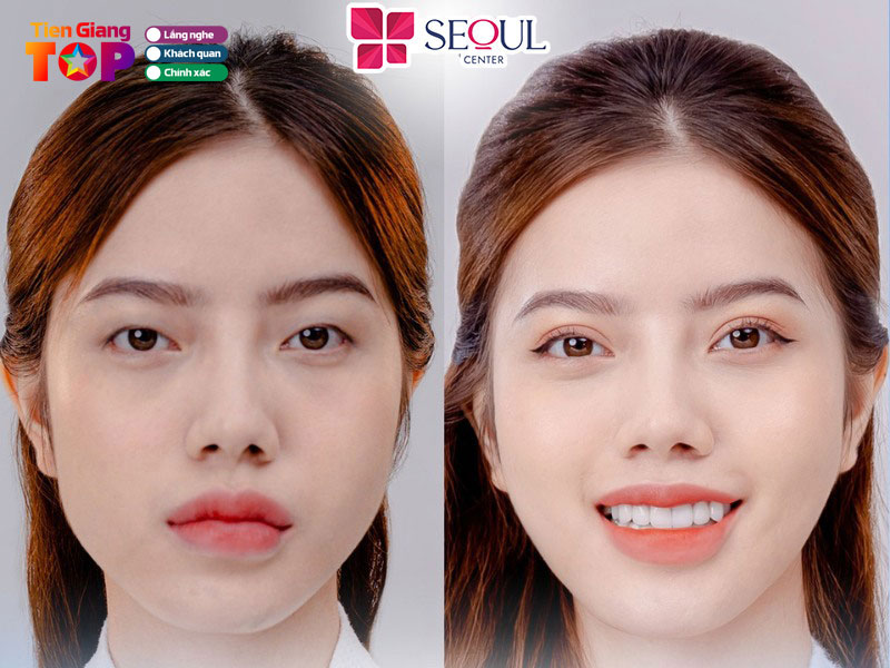 Tham-my-vien-seoul-center-tiengiangtoplist