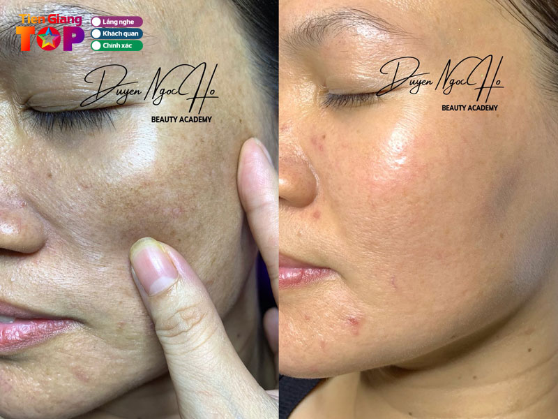 Duyen-spa-my-tho-tiengiangtoplist