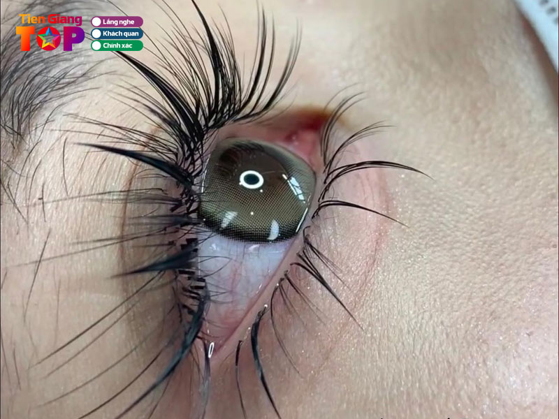 Huynh-trang-noi-mi-spa-tiengiangtoplist