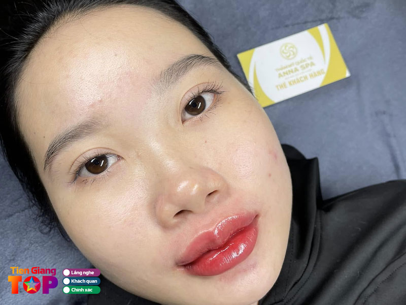 Vien-tham-my-anna-spa-tiengiangtoplist