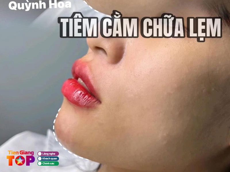 Tham-my-quoc-te-thanh-hang-tiengiangtoplist