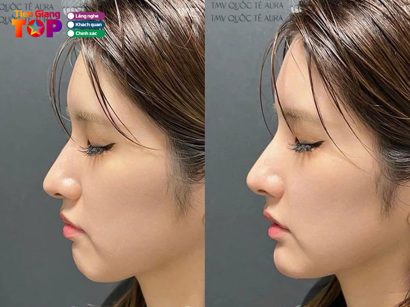 Tham-my-vien-quoc-te-aura-tiengiangtoplist