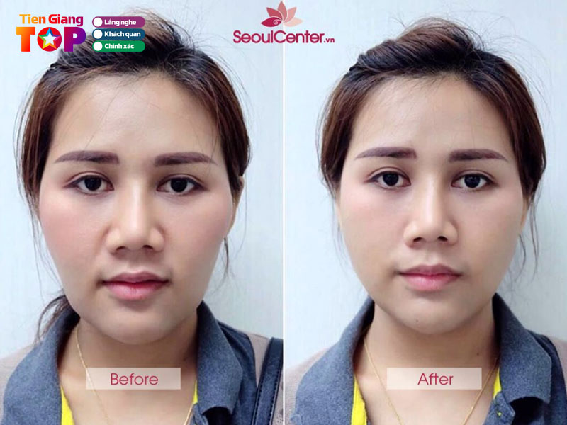 Tham-my-vien-seoul-center-tiengiangtoplist