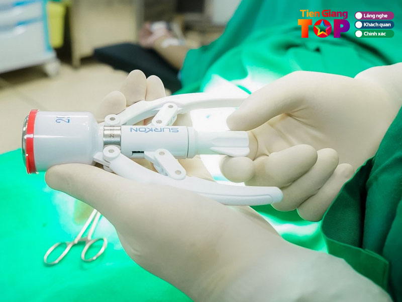 Khi-nao-nen-cat-bao-quy-dau-tiengiangtoplist