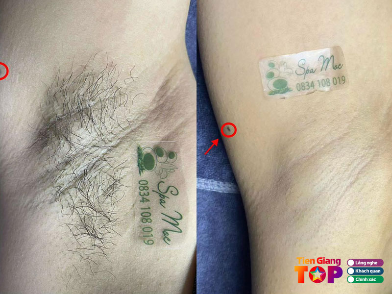 Moc-beauty-spa-tiengiangtoplist