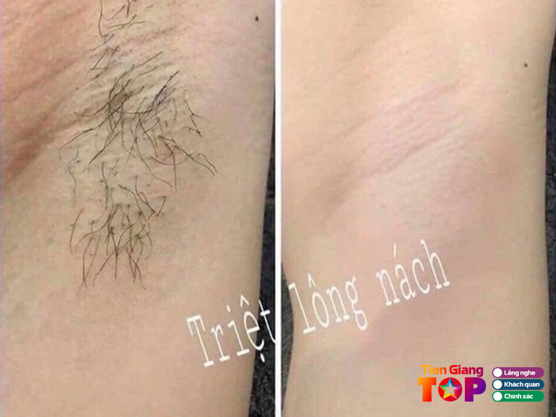 Thanh-thuy-spa-tiengiangtoplist