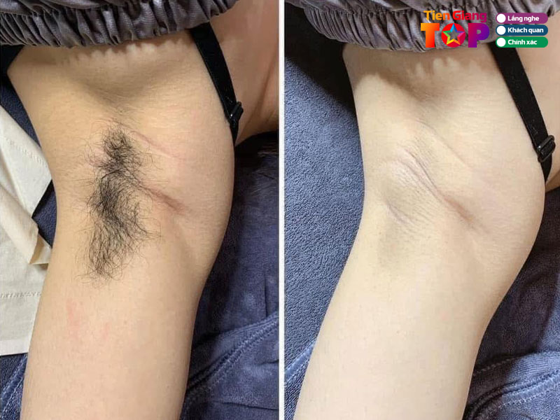 Tho-spa-tiengiangtoplist