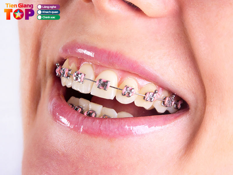 Nha-khoa-tam-dental-center-tiengiangtoplist