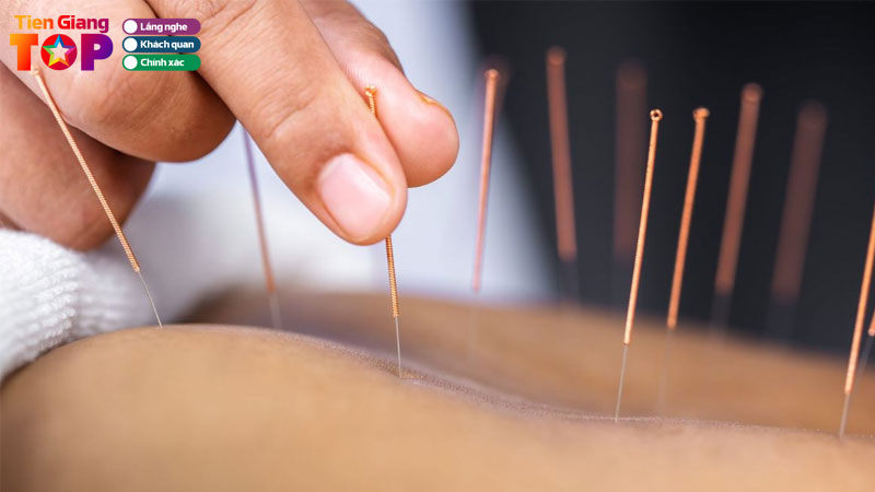 Top-5-dia-diem-cham-cuu-tai-tien-giang-hieu-qua-co-chuyen-mon-tiengiangtoplist