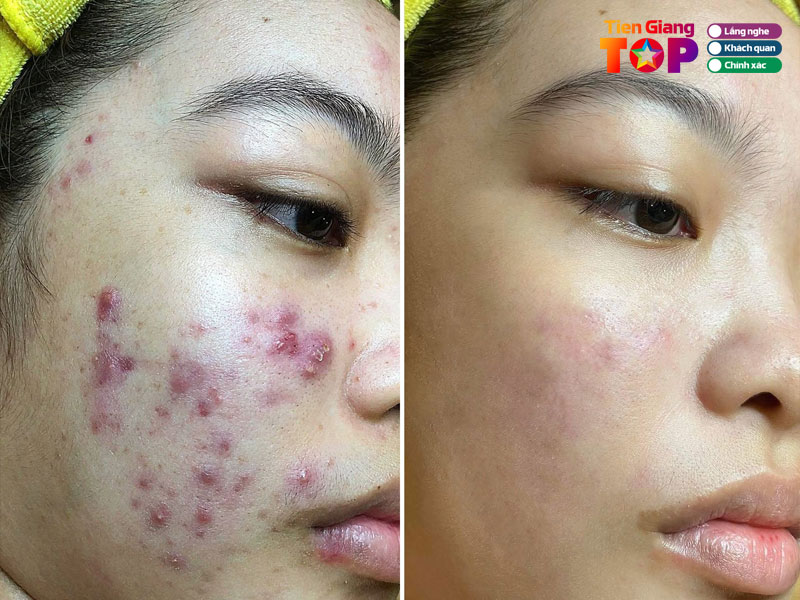 Beauty-salon-ngoc-huong-tiengiangtoplist