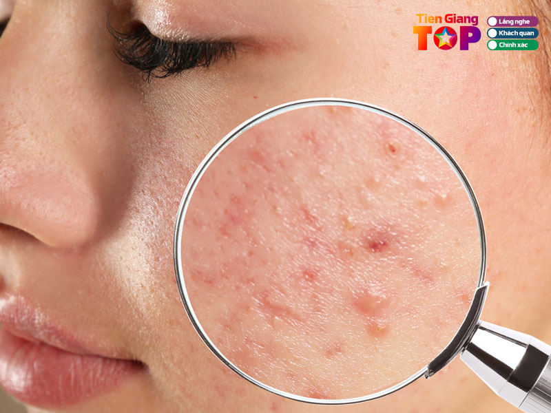 Spa-beauty-de-siam-tiengiangtoplist