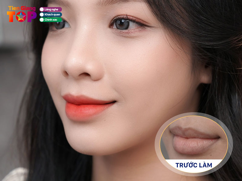 Vien-tham-my-korea-tiengiangtoplist