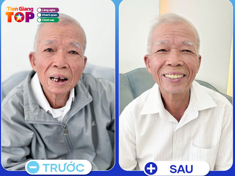 Nha-khoa-ador-tiengiangtoplist