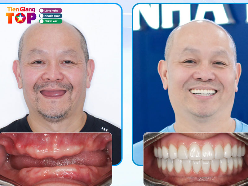 Nha-khoa-kim-tiengiangtoplist