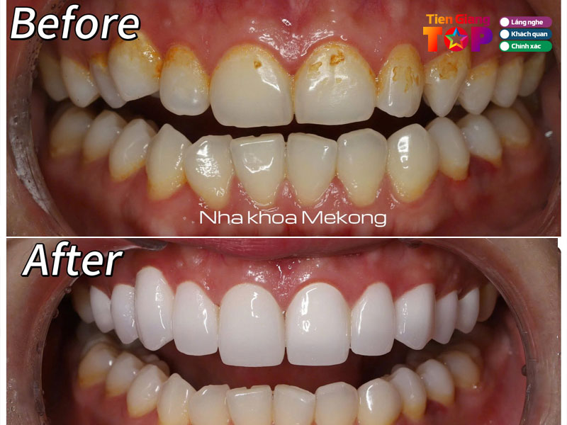 Nha-khoa-mekong-tiengiangtoplist