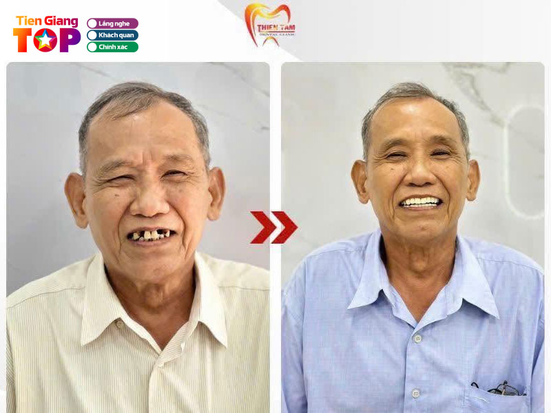 Nha-khoa-sai-gon-thien-tam-tiengiangtoplist