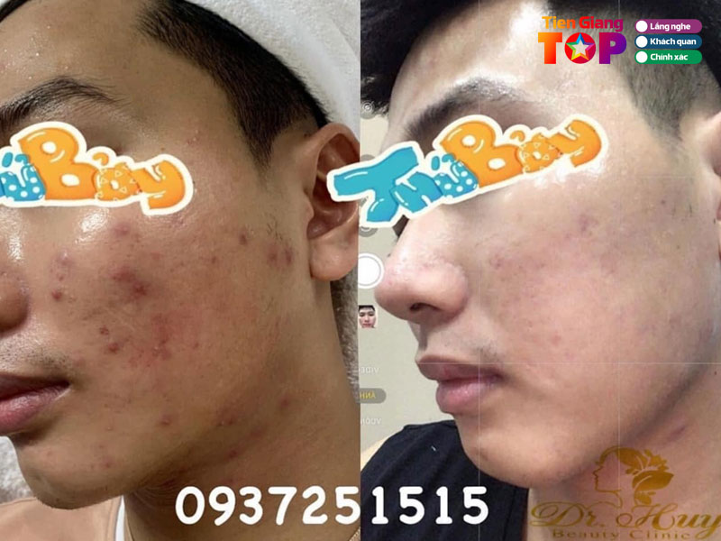 Lam-beauty-spa-tiengiangtoplist