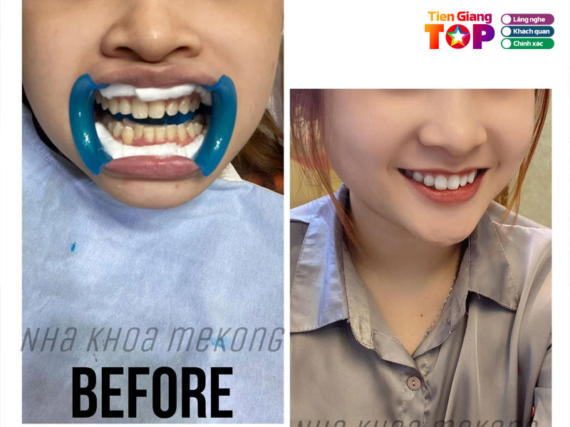 Nha-khoa-mekong-tiengiangtoplist