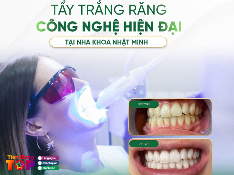 Nha-khoa-nhat-minh-tiengiangtoplist