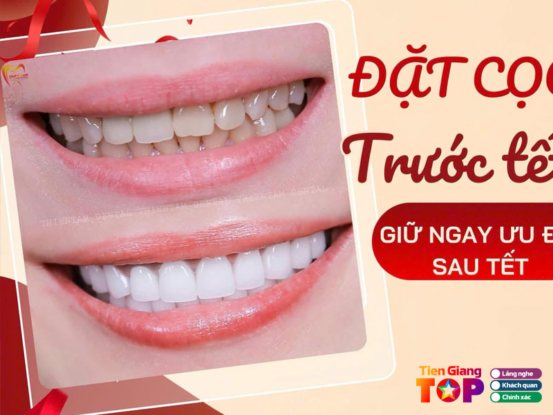 Nha-khoa-sai-gon-thien-tam-tiengiangtoplist