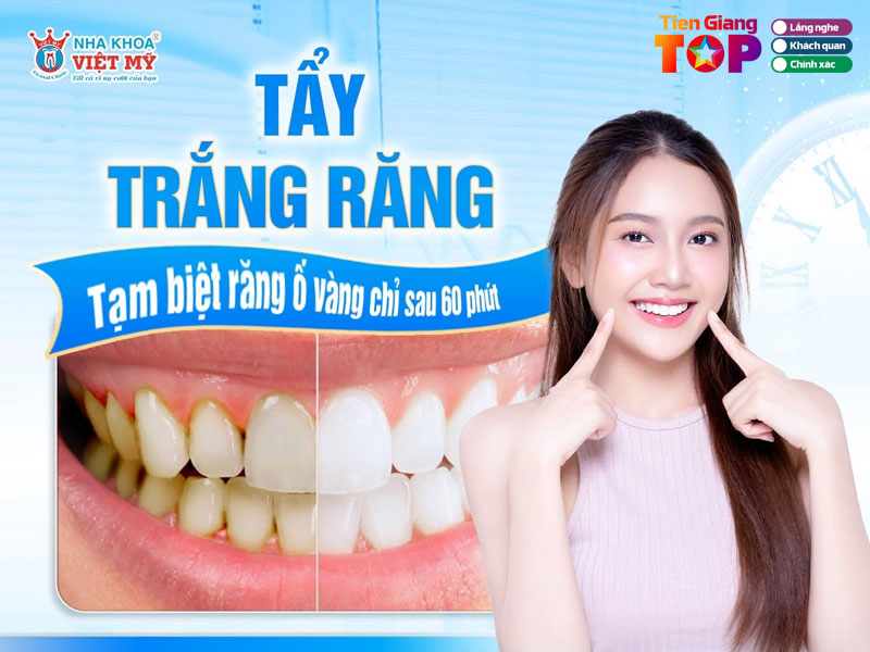 Nha-khoa-viet-my-tiengiangtoplist