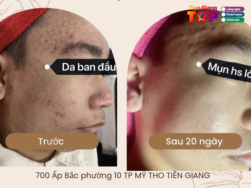 Spa-ngoc-thanh-tiengiangtoplist